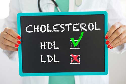 Cholesterol